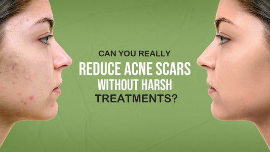 Is There an Easy Way to Reduce Acne Scars?